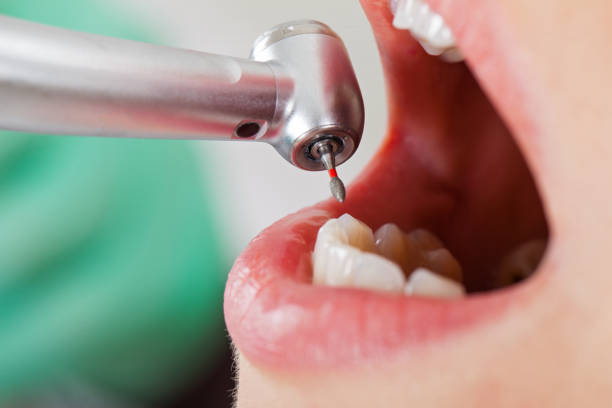 Best After-Hours Emergency Dentist in North Eagle Butte, SD